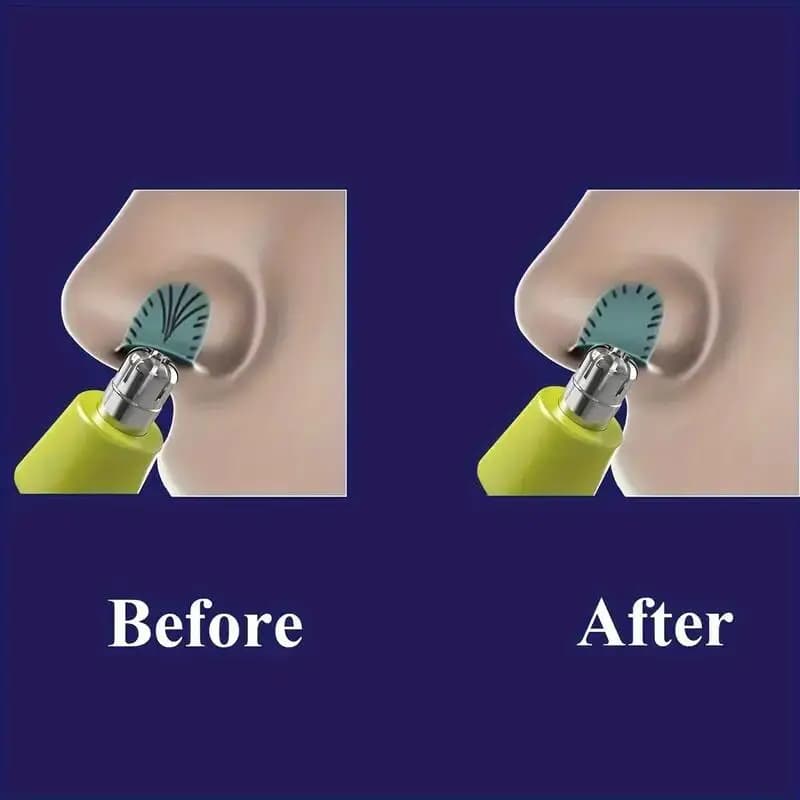 رأس استبدال لمزيل شعر الأنف متوافق مع فيليبس ون بليد وون بليد برو شفرات مزدوجة مقاومة للماء - 5