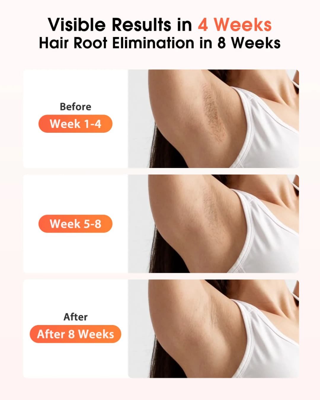أجهزة IPL لإزالة الشعر بالليزر 17J 999900   نبضات الضوء HR/SC/RA 9 مستويات لإزالة الشعر غير المؤلم للجسم بالكامل للاستخدام المنزلي للرجال والنساء - 3