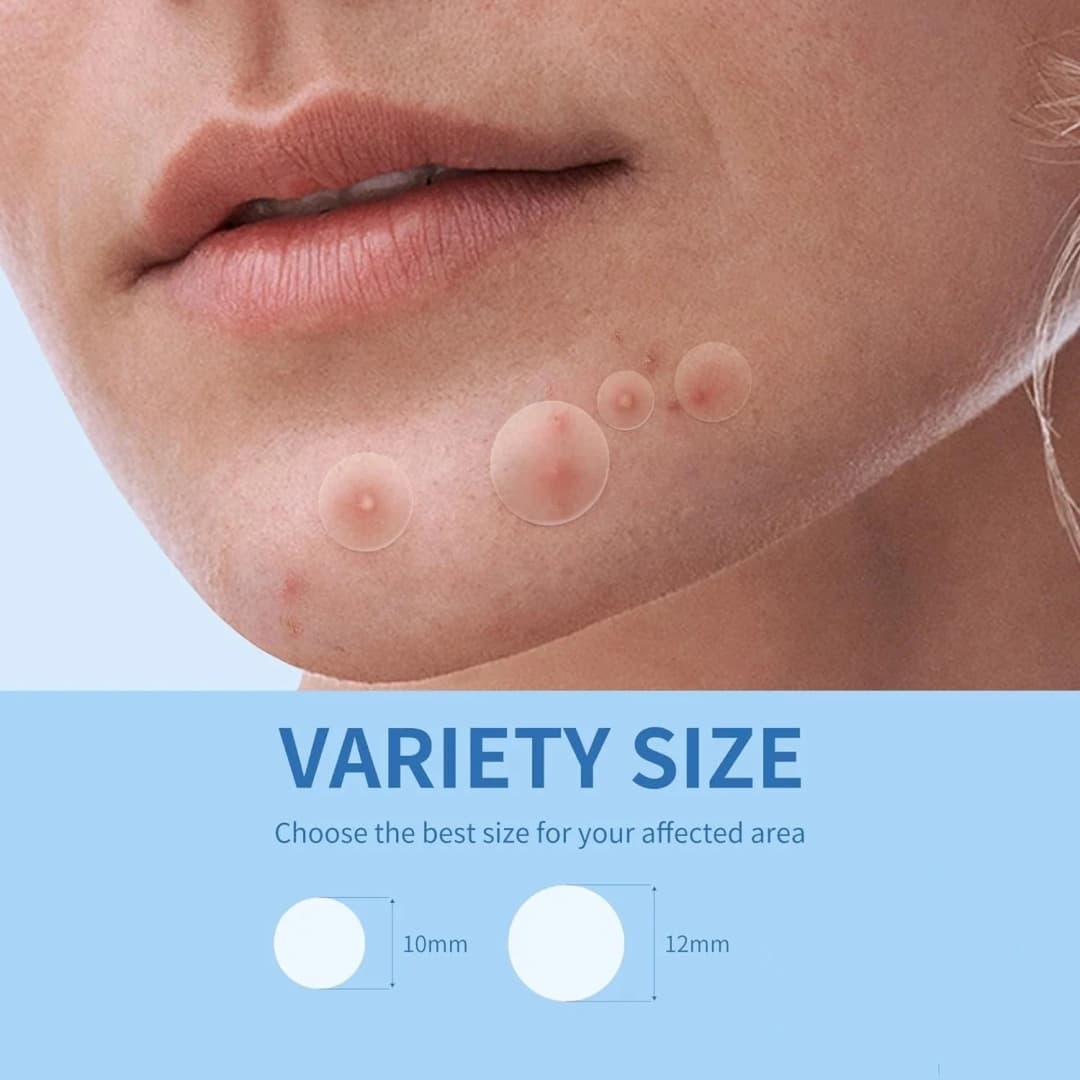 360pcs Face Acne Patch Invisible Skin Care Pimple Acne Patches Anti-inflammatory Healing Absorbing Spot Sticker Covering Acne - 6